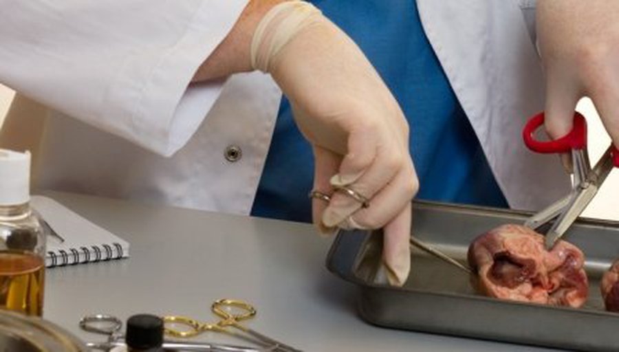 Už prekybą žmogaus organais nuteisti penki asmenys - Pasaulyje