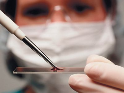 Депрессию у подростков будут выявлять по анализу крови                                 - Наука и здоровье