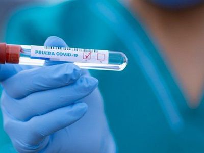 VPSPC проводит платные  ПЦР‑тесты на COVID‑19 - В Висагинасе