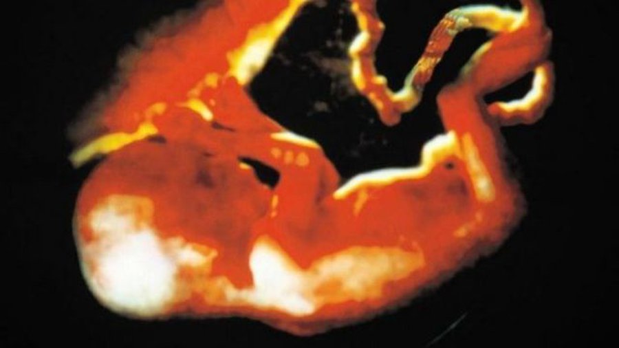 Предлагающий запретить аборты З.Едински: разрушил муравейник – штраф, убил ребенка – ничего - Литва и страны Балтии