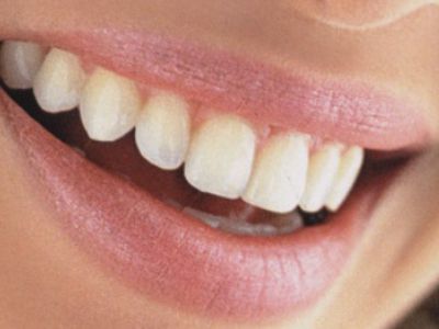 Японцы придумали искусственную зубную эмаль - Наука и здоровье