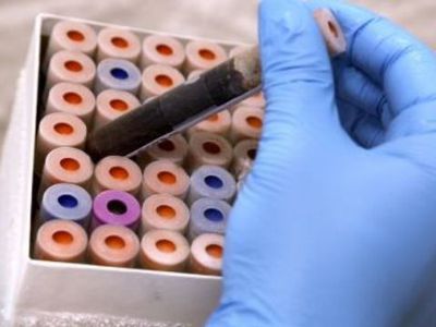 Ученые США объявили о конце эры антибиотиков - Наука и здоровье