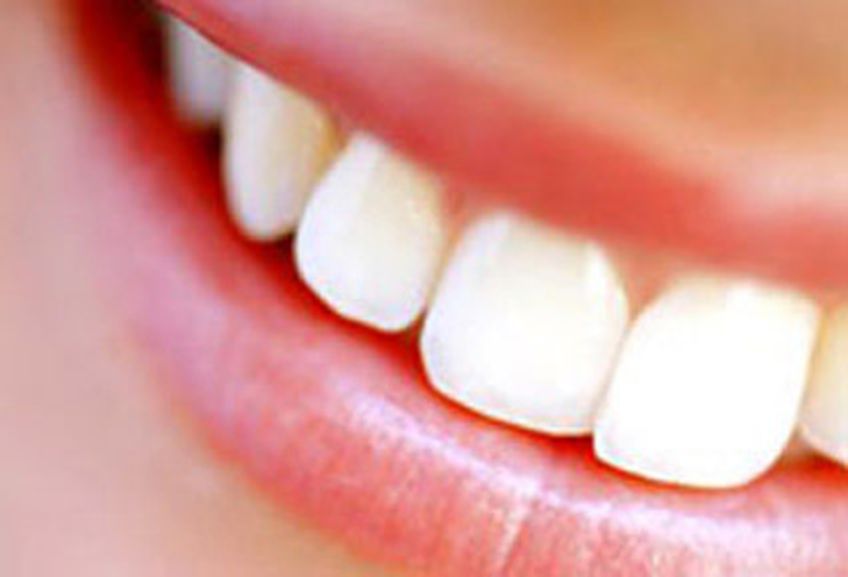 Интересные и занимательные факты из истории стоматологии                