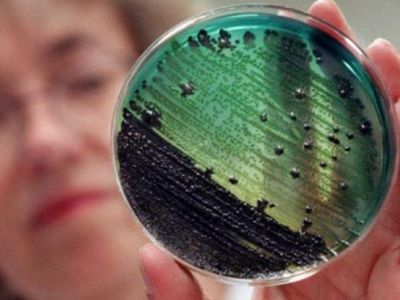 Maistinės zoonozės - Visagine