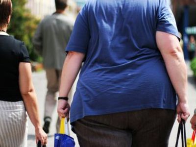 Доклад: раньше умирали от голода, теперь от ожирения


 - Наука и здоровье