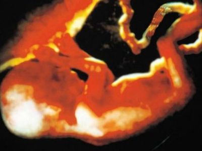 Предлагающий запретить аборты З.Едински: разрушил муравейник – штраф, убил ребенка – ничего - Литва и страны Балтии