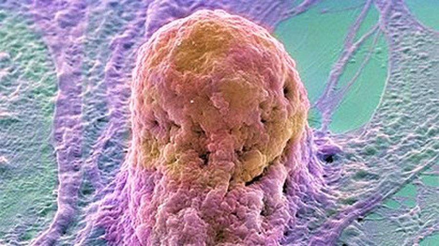 Выращивание органов с помощью стволовых клеток может стать реальностью
 - Наука и здоровье