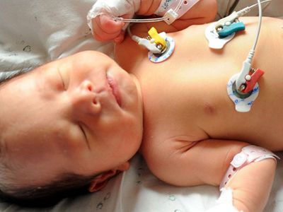 В Китае младенец «воскрес» прямо перед собственной кремацией - В Мире