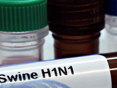 В Литве зафиксирован первый смертельный случай от гриппа A(H1N1)

 - Наука и здоровье