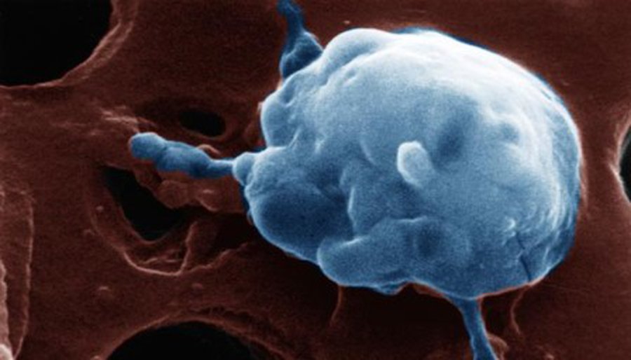 Нобелевскую премию получили борцы с раком - Наука и здоровье