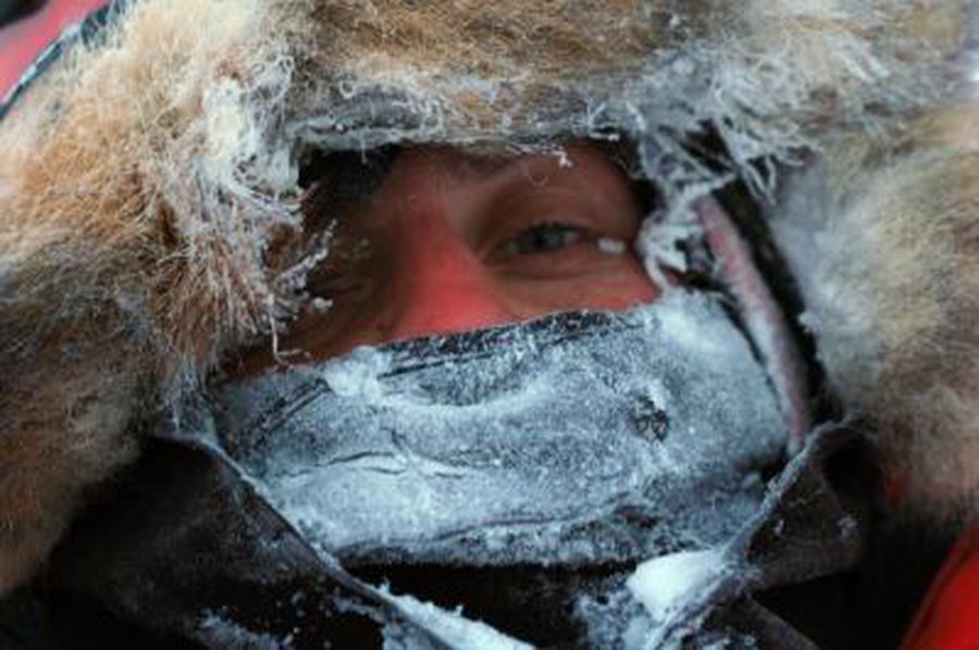 Anot medikų, šaltis jau grasina - Lietuva ir Baltijos šalys