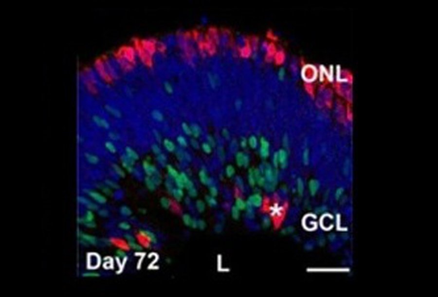 Учёные впервые вырастили сетчатку из клеток крови человека                                                                                             - Наука и здоровье