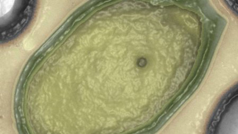 Susipažinkite – didžiausias pasaulyje virusas - Pasaulyje