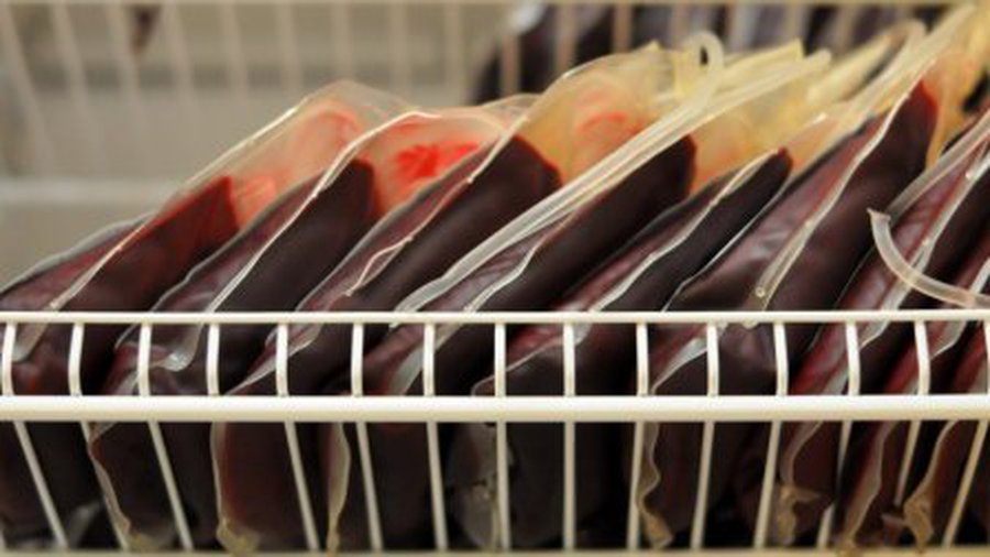 У донора перелитой пациентам крови позднее диагностировали ВИЧ - Наука и здоровье